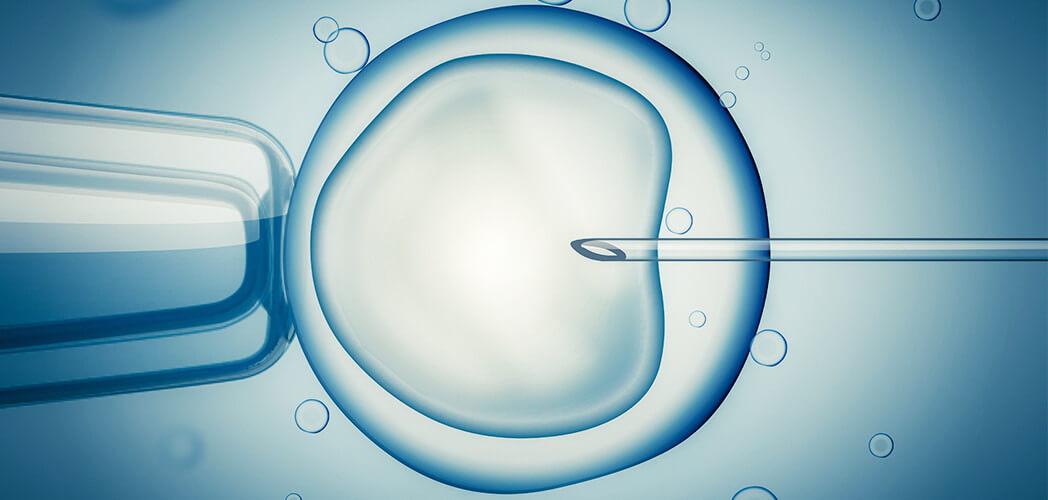 IVF- In-Vitro Fertilization